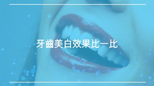 牙齒美白效果比一比