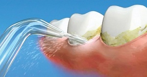 簡單用高潔淨 21最齊全好品牌一次看 沖牙機推薦top6 快樂牙齒