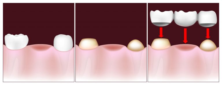  Happy Teeth