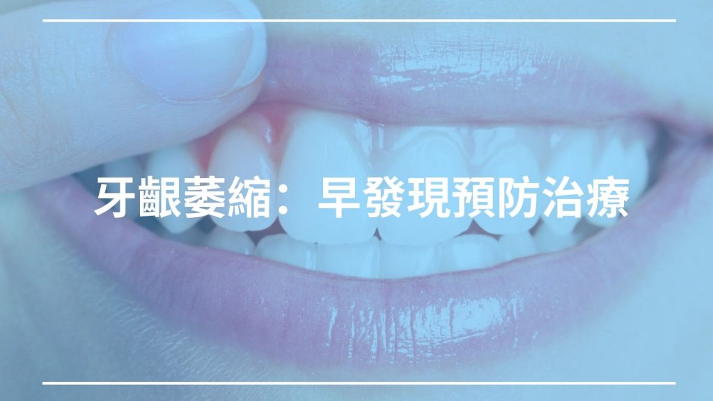 牙齦萎縮 原因 併發症及早發現預防治療 快樂牙齒happy Teeth