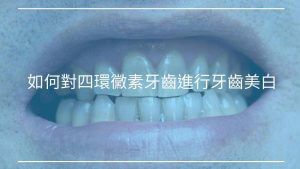 如何對四環黴素牙齒進行牙齒美白