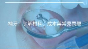 補牙：了解補牙材料、成本與補牙後常見問題