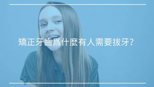 【矯正迷思】矯正牙齒爲什麼有人需要拔牙？有人不用呢？